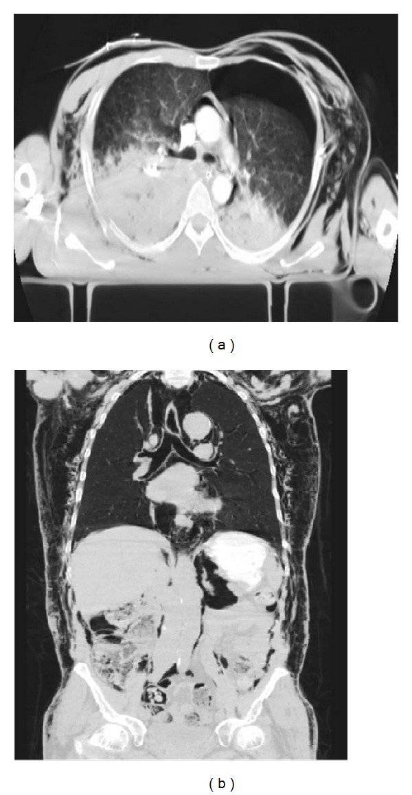 Figure 18