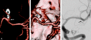 Fig 3.