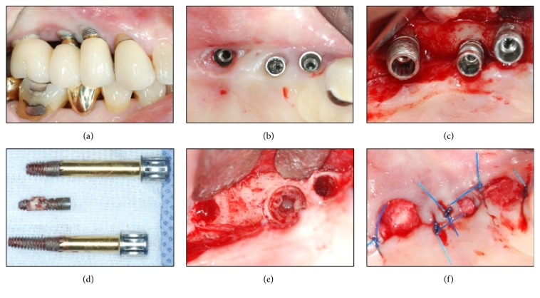 Figure 6