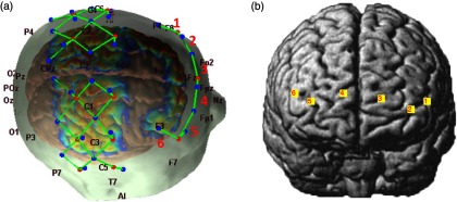 Fig. 1