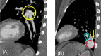 Fig. 4 –