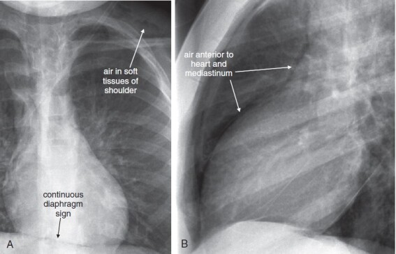 Figure 5-156