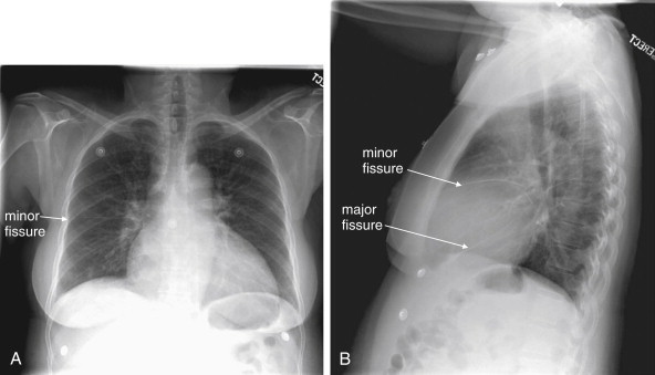 Figure 5-30