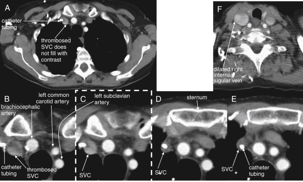 Figure 5-182