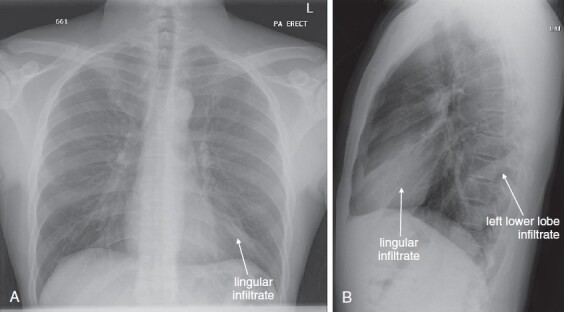 Figure 5-58