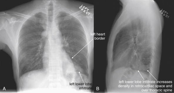 Figure 5-60