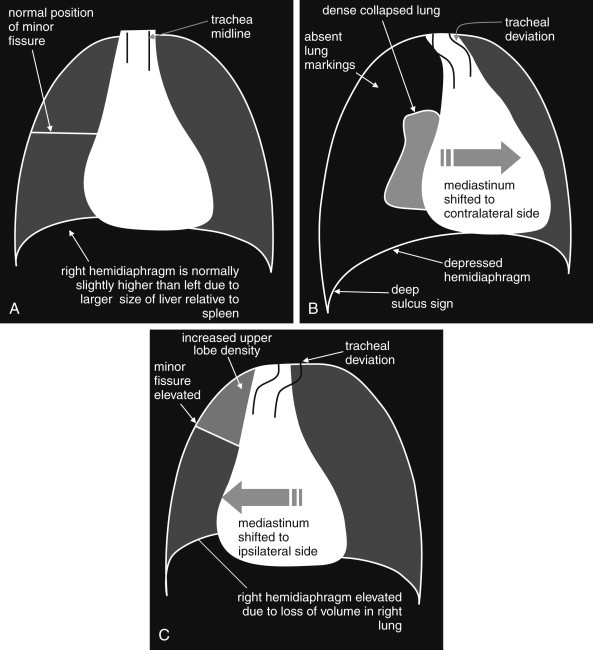 Figure 5-35