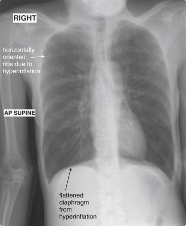 Figure 5-42