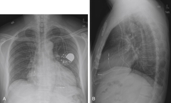 Figure 5-31