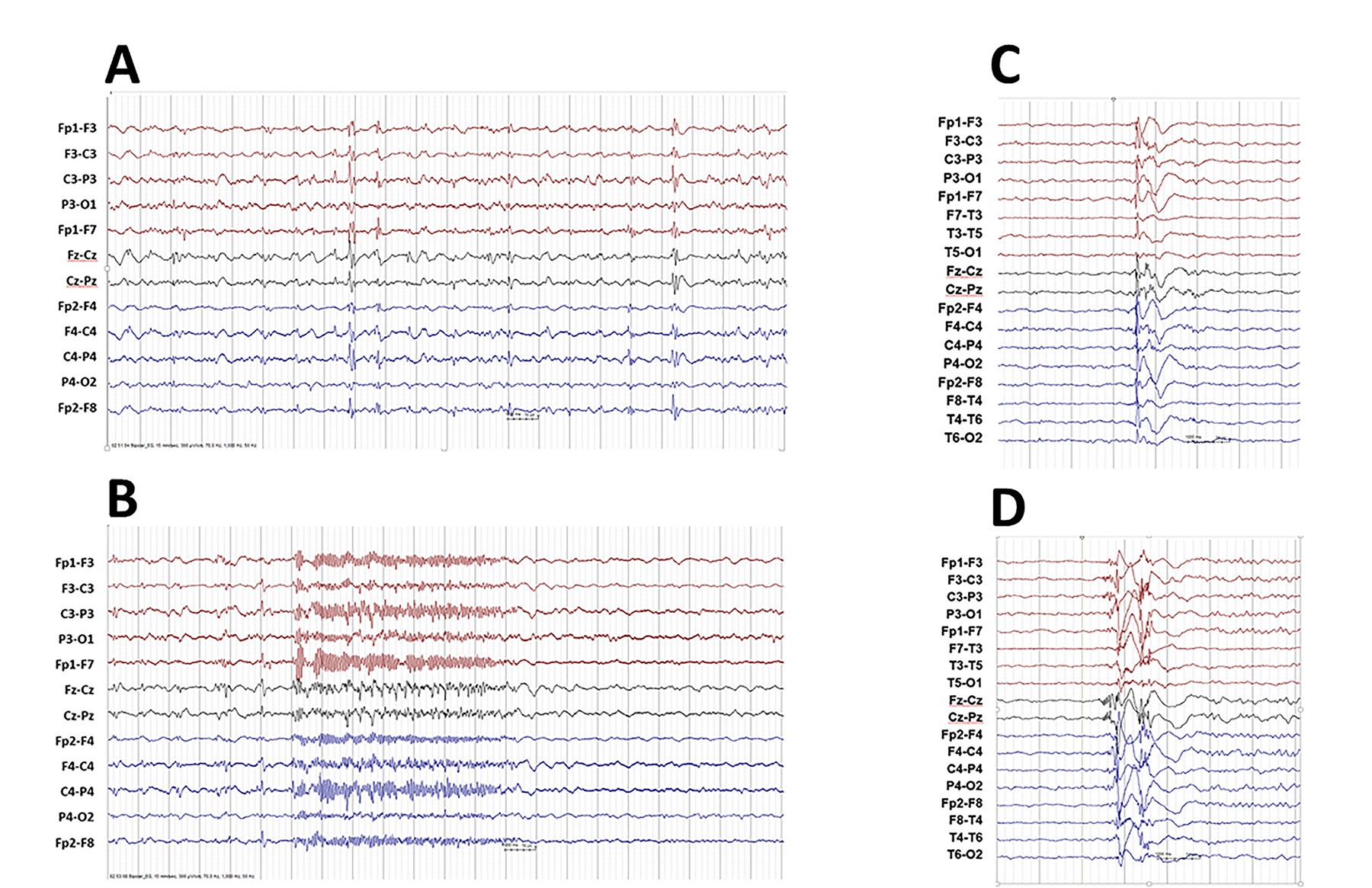 Figure 1A-B; C-D.