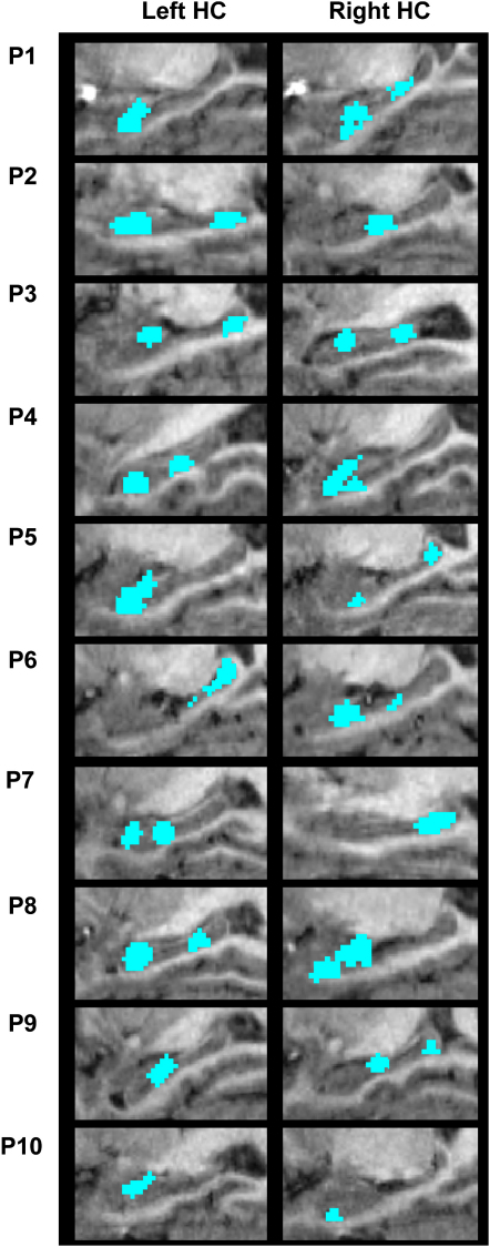 Figure 3