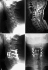 Fig. 4