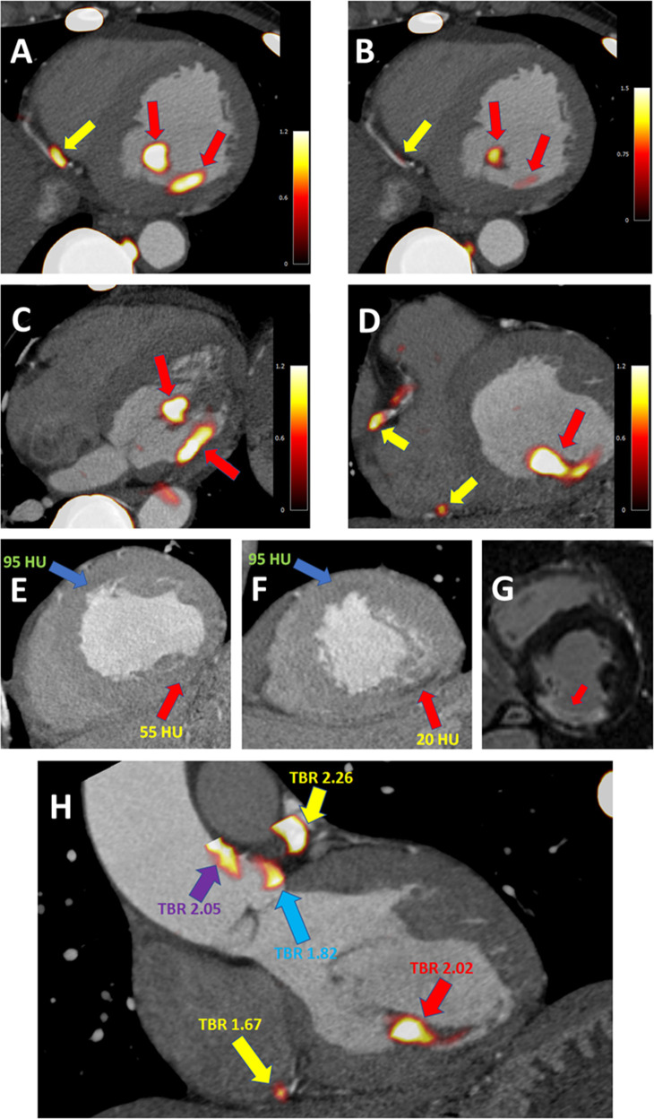 Figure 6.