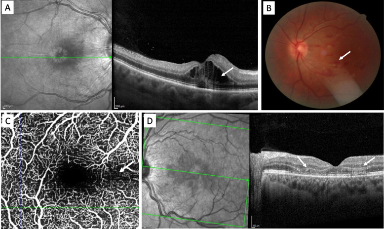 Fig. 1 