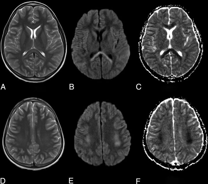 FIG 2.