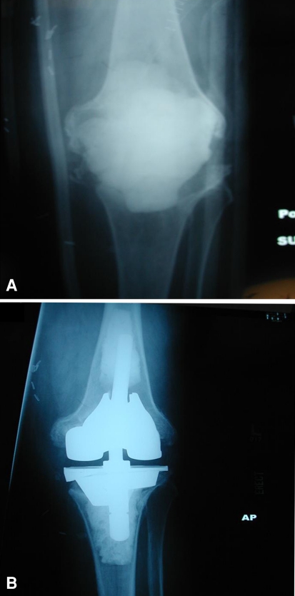 Fig. 2A–B