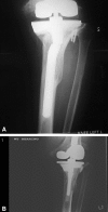 Fig. 1A–B