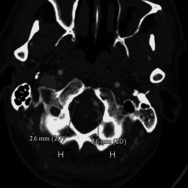 Fig. 3