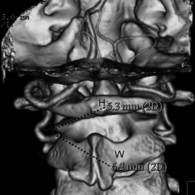 Fig. 1