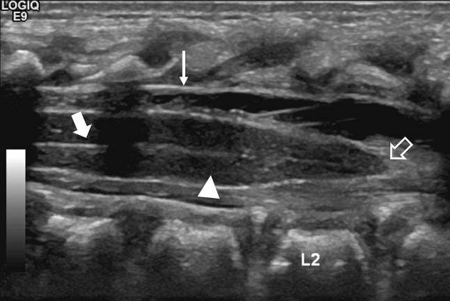 Fig. 1