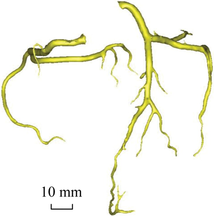 Figure 2d: