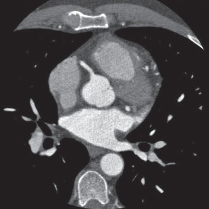 Figure 2b: