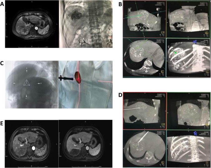 Fig. 1