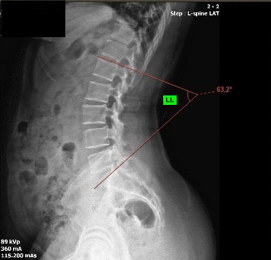 Fig. 2