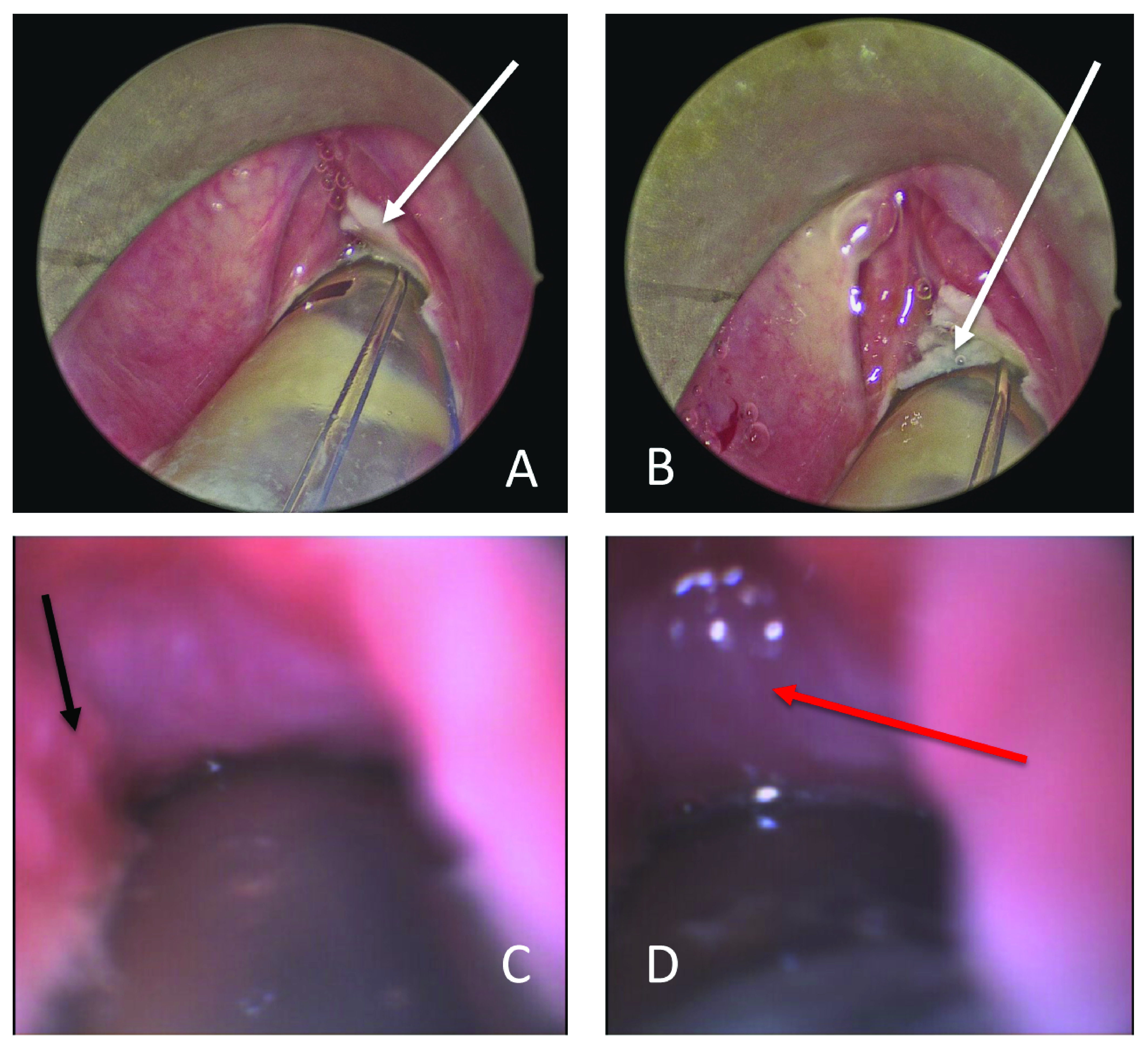 Figure 4. 