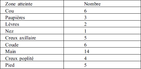 Tableau II