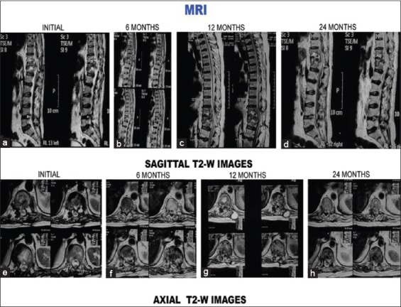 Figure 1 (C)