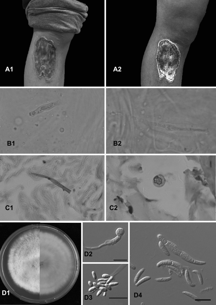 Fig. 1