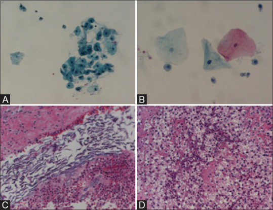 Figure 13(A-D)