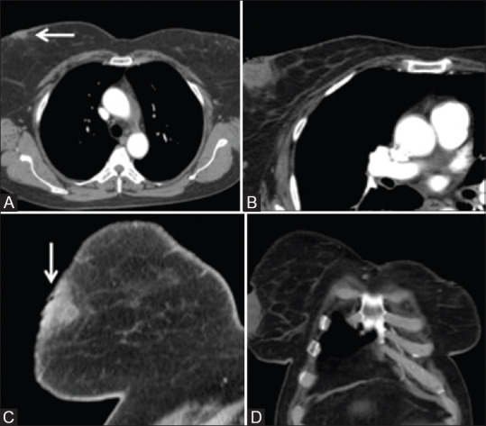 Figure 1(A-D)