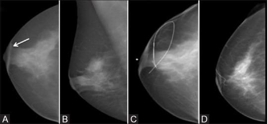 Figure 15(A-D)