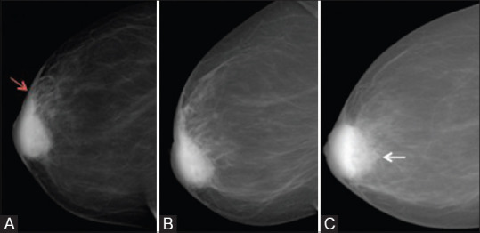 Figure 2(A-C)