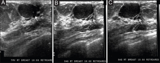 Figure 14