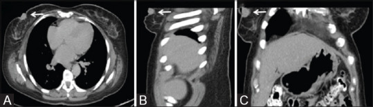 Figure 6(A-C)