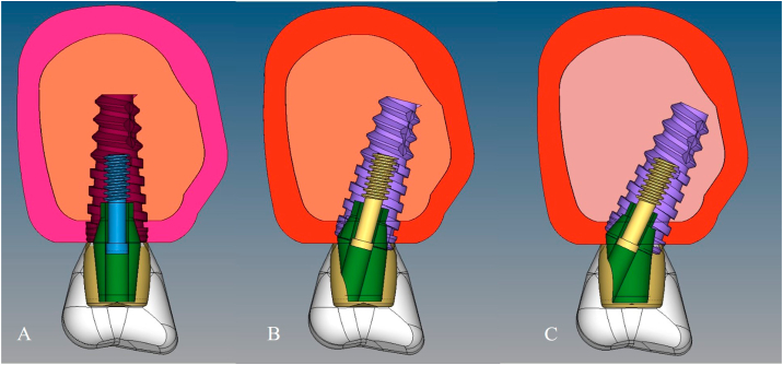 Fig. 1