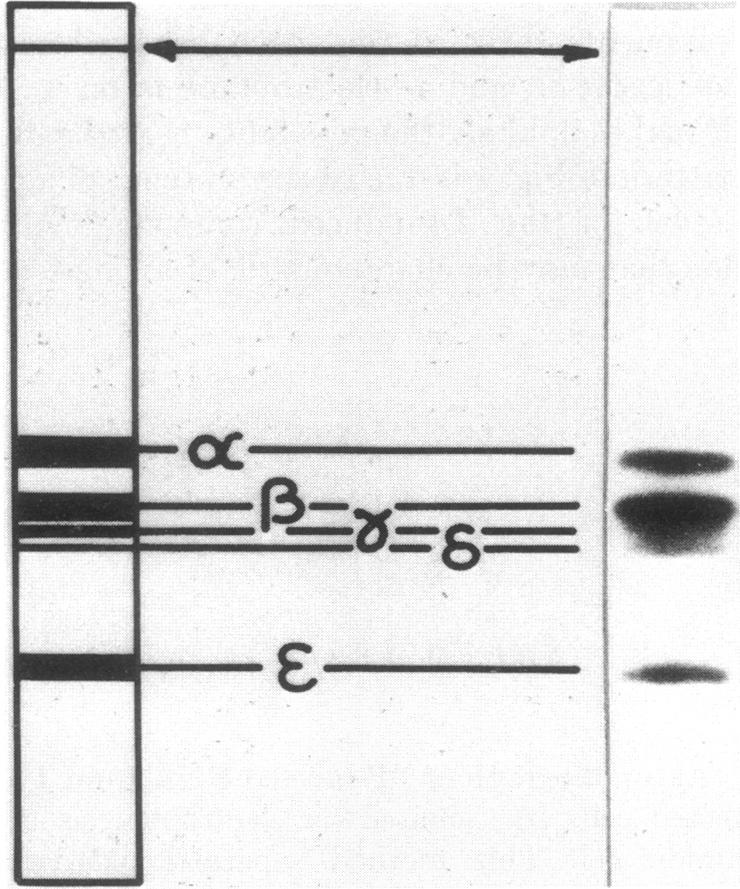 graphic file with name pnas00090-0214-a.jpg