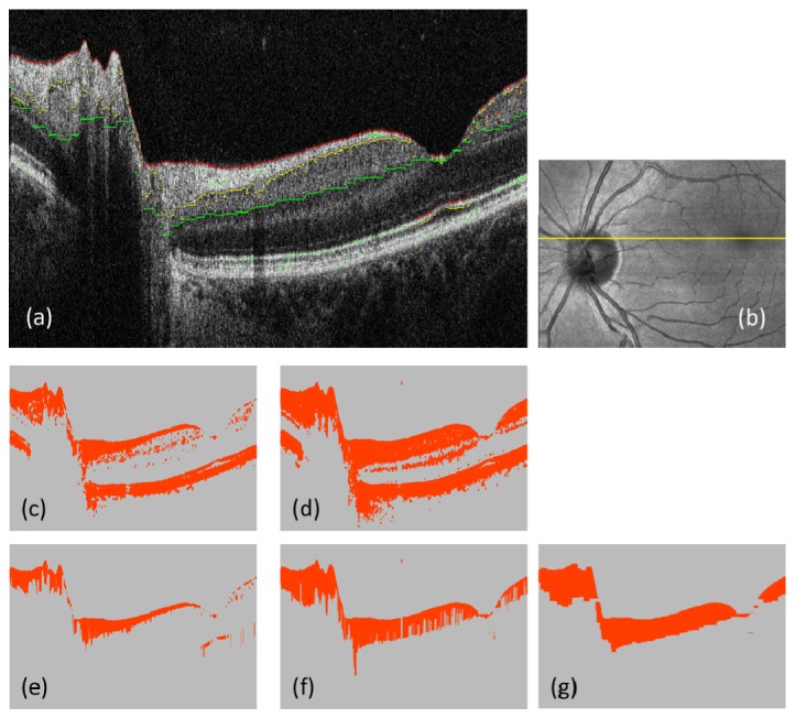 Fig. 2