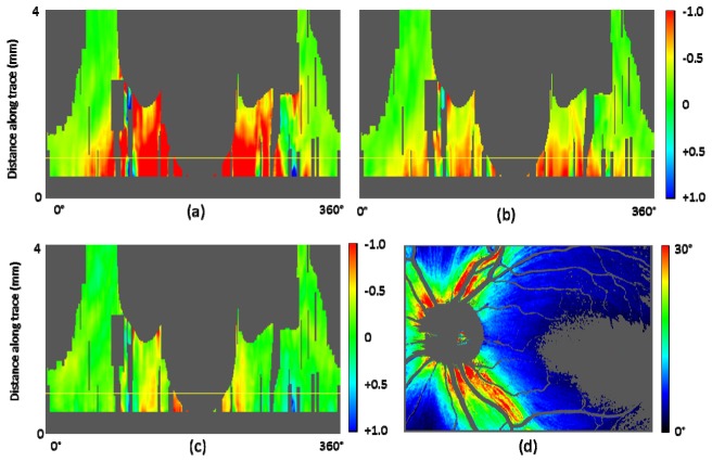 Fig. 12