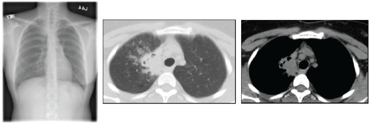 Fig. (6)