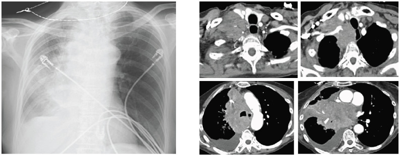 Fig. (3)