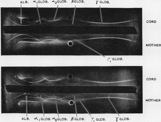 graphic file with name jclinpath00065-0087-a.jpg