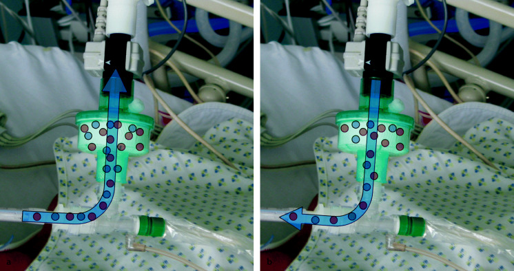 graphic file with name 6376_9_De_54_Fig2_HTML.jpg