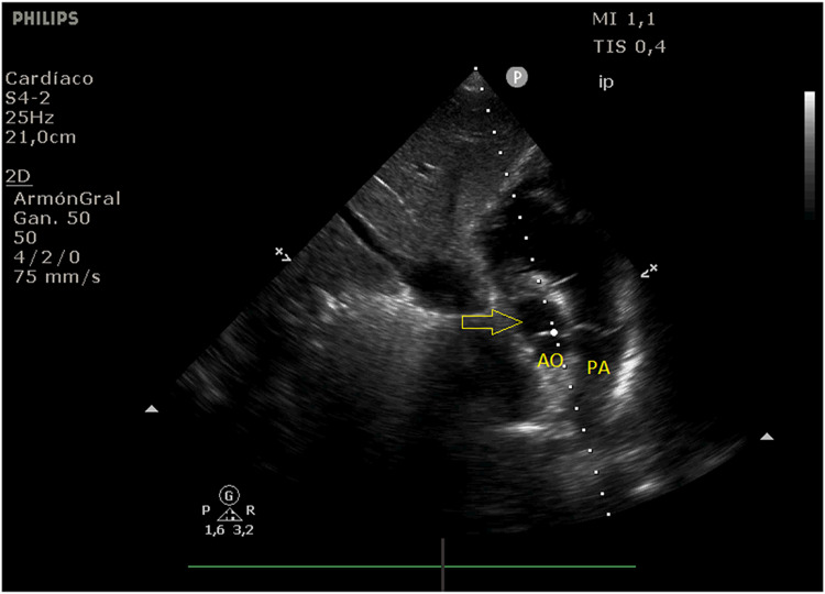 Fig. 2