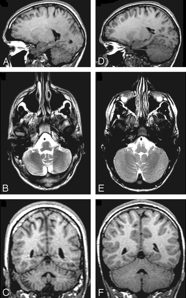 Fig 4.