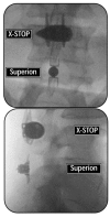 Fig. (10)