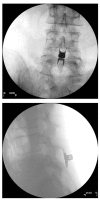 Fig. (2)